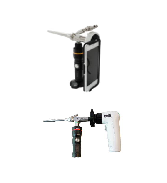 Video Otoscope and Rhinoscope